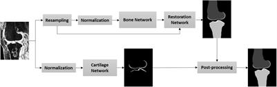 Knee Bone and Cartilage Segmentation Based on a 3D Deep Neural Network Using Adversarial Loss for Prior Shape Constraint